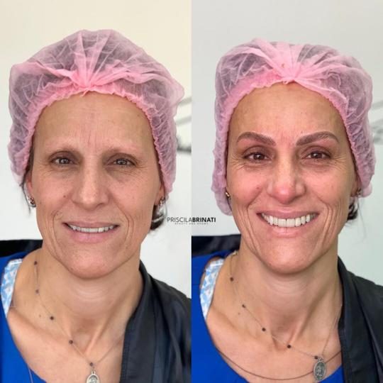micropigmentacao-sobrancelha-priscila-11.jpeg